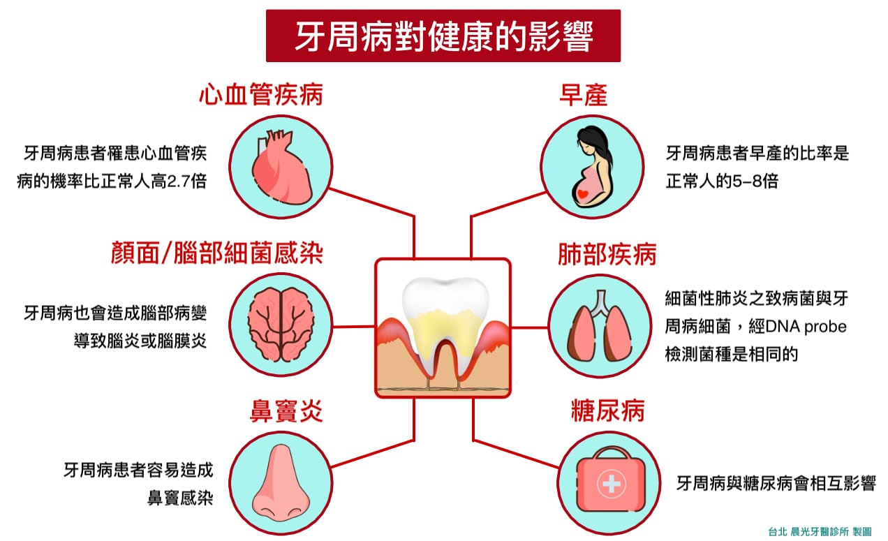 什么是牙周疾病图片素材-编号16344990-图行天下